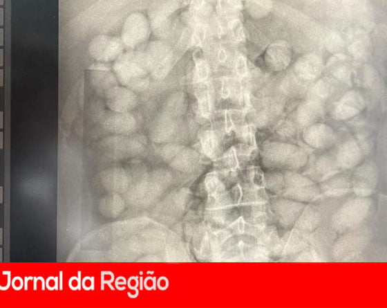 Como o uso de Raio-X auxilia na detecção de drogas em aeroportos