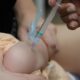 A Batalha Contra o Influenza Como a Vacina o em Dois Atos Promete Proteger Milh es em 2025