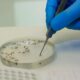 A Epidemia Silenciosa Jaguari na Registra Terceira Morte por Dengue em 2025 E Agora