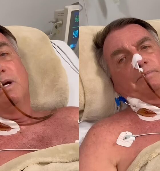 Bolsonaro Internado: O Que Há Por Trás da Nova Crise de Saúde do Ex-Presidente? 16 Bolsonaro Internado O Que H Por Tr s da Nova Crise de Sa de do Ex Presidente