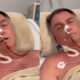 Bolsonaro Internado O Que H Por Tr s da Nova Crise de Sa de do Ex Presidente