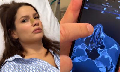 Juliette Freire Fratura Nariz em Acidente Dom stico Uma Reflex o Sobre Vida P blica Vulnerabilidade e Resili ncia
