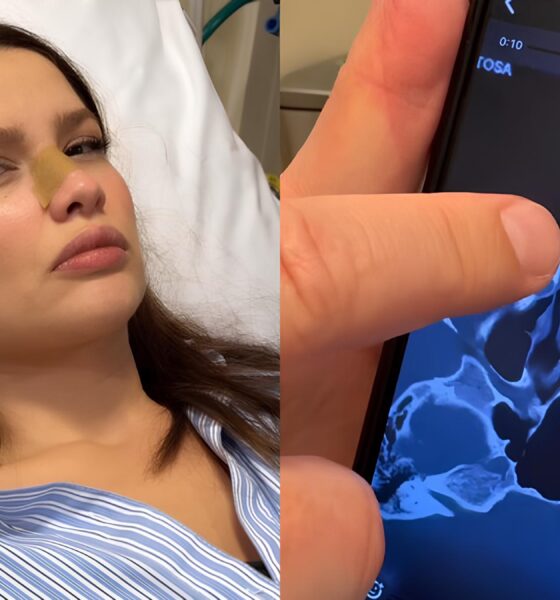 Juliette Freire Fratura Nariz em Acidente Doméstico: Uma Reflexão Sobre Vida Pública, Vulnerabilidade e Resiliência 16 Juliette Freire Fratura Nariz em Acidente Dom stico Uma Reflex o Sobre Vida P blica Vulnerabilidade e Resili ncia