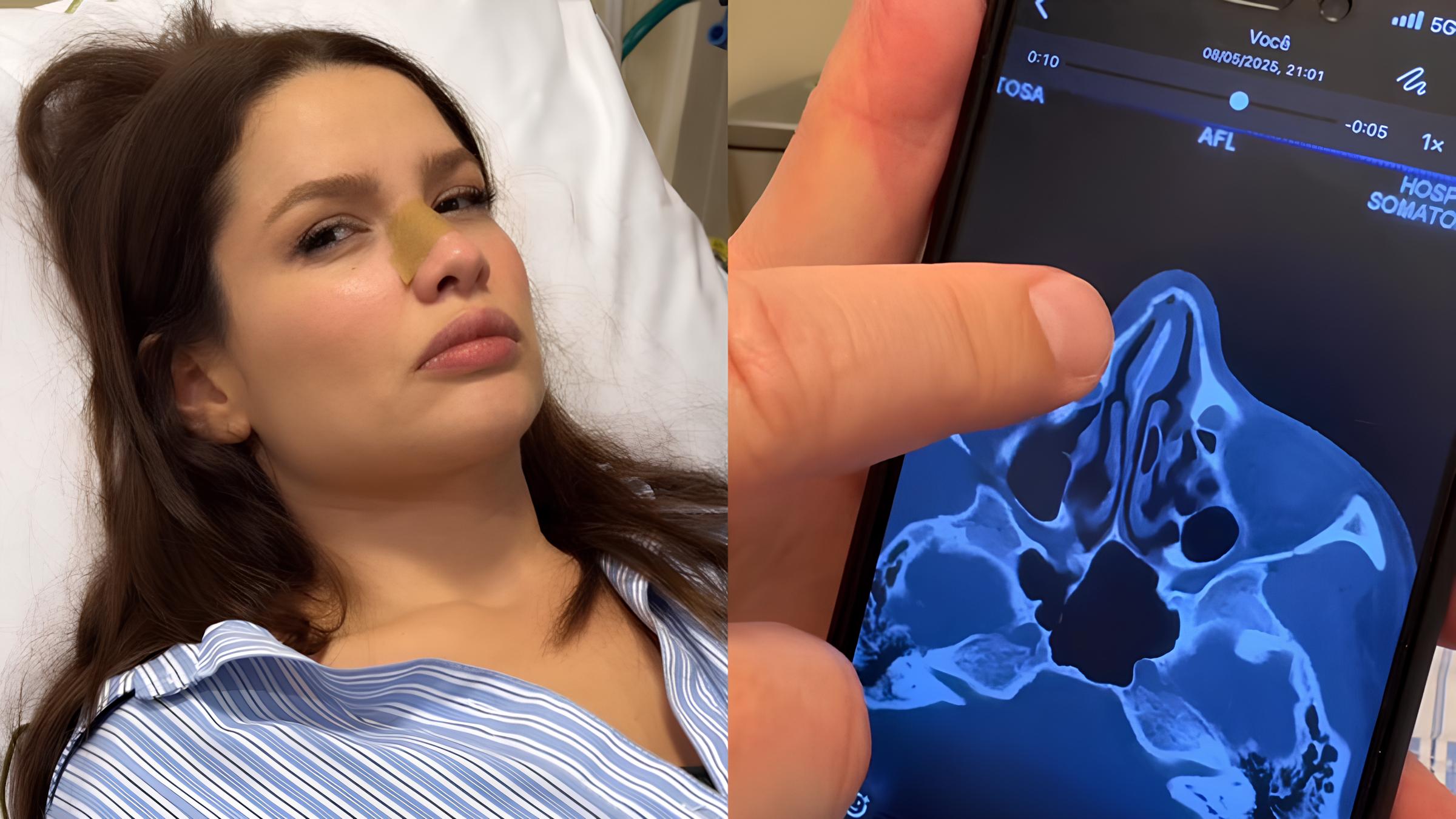 Juliette Freire Fratura Nariz em Acidente Doméstico: Uma Reflexão Sobre Vida Pública, Vulnerabilidade e Resiliência 15
