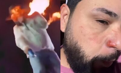 L o do Sertanejo L o Raphael O Dia em que o Palco Virou um Inferno Como Ele Est Recuperando Sua Vida Ap s Queimaduras Graves