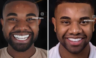 Davi Brito A Transforma o de Sorriso que Custou R 60 Mil e Virou Assunto nas Redes Sociais