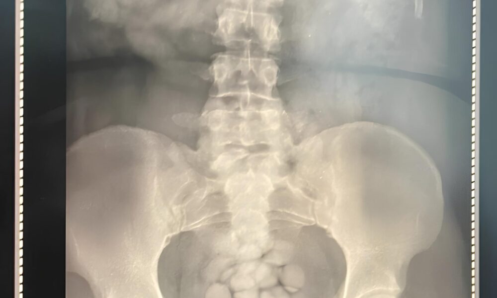 O Fim de um Império das Sombras: Como a Polícia Federal Desbaratou uma Organização Internacional de Tráfico de Drogas por Aeroportos 40 O Fim de um Imp rio das Sombras Como a Pol cia Federal Desbaratou uma Organiza o Internacional de Tr fico de Drogas por Aeroportos