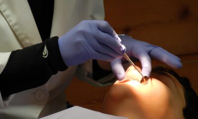 Quando Ir ao Dentista se Tornou um Risco de Vida: A Trágica História por Trás das Extrações de Siso 32 Quando Ir ao Dentista se Tornou um Risco de Vida A Tr gica Hist ria por Tr s das Extra es de Siso