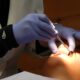 Quando Ir ao Dentista se Tornou um Risco de Vida: A Trágica História por Trás das Extrações de Siso 15 Quando Ir ao Dentista se Tornou um Risco de Vida A Tr gica Hist ria por Tr s das Extra es de Siso